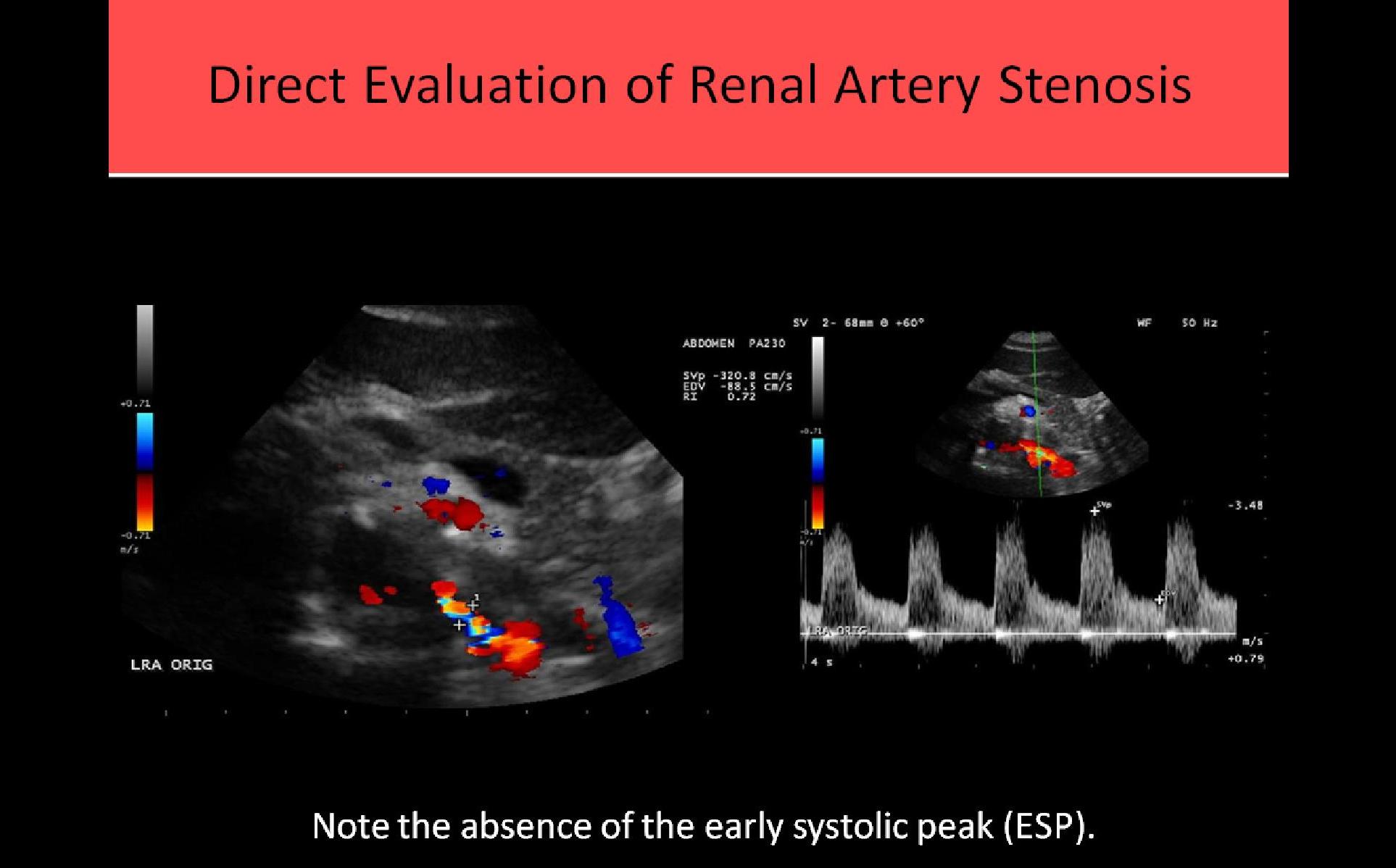 Vascular Ultrasound Training Programs