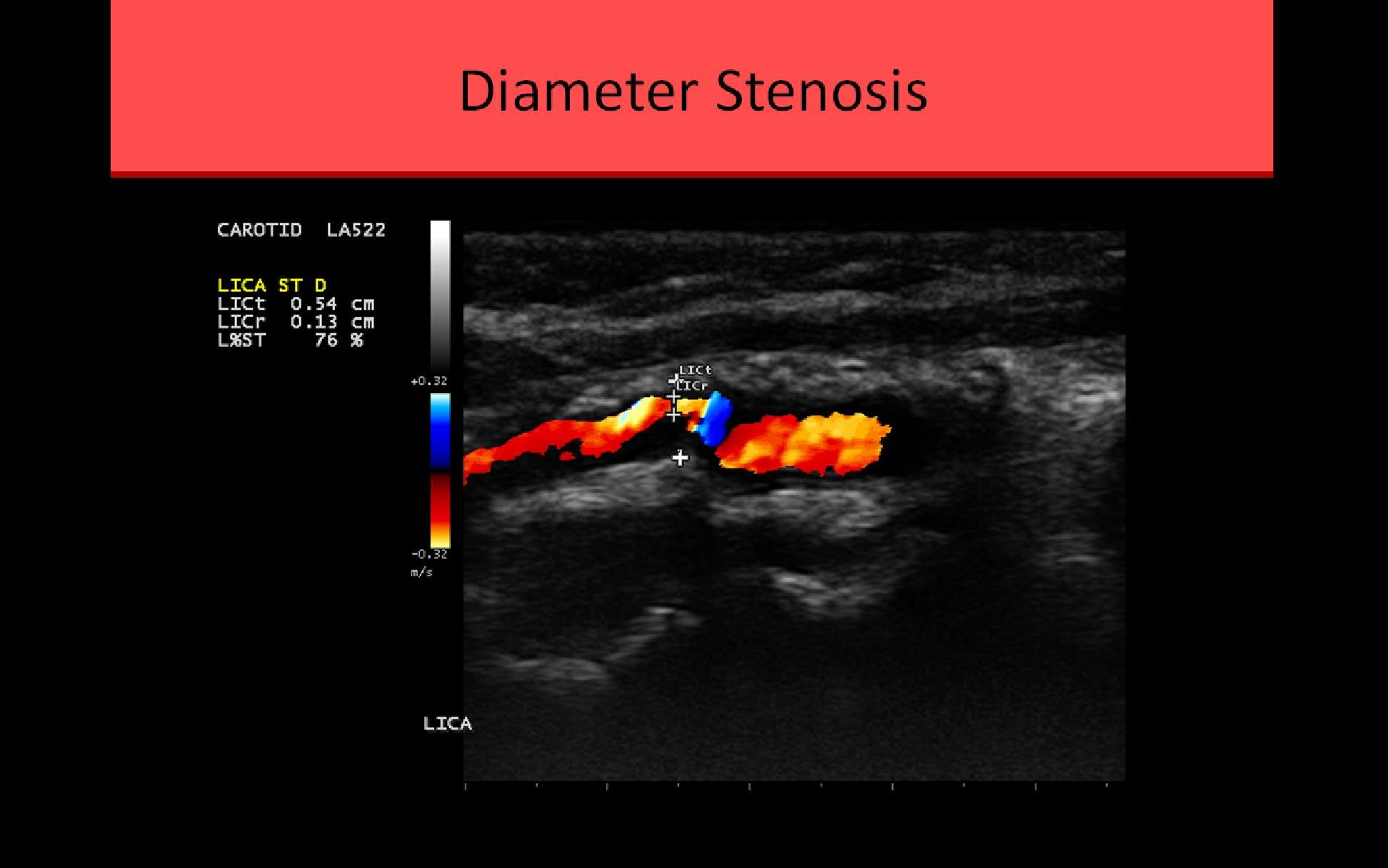 Vascular Ultrasound Registry Review Course