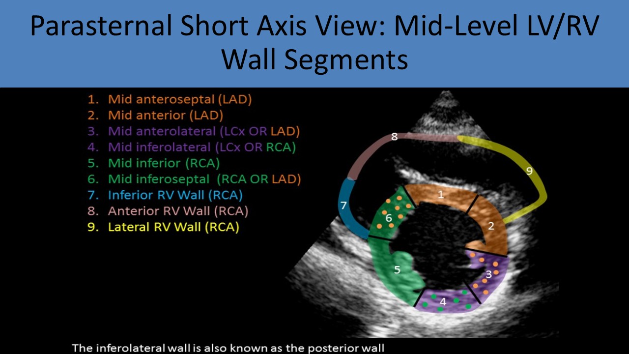 Adult echocardiography image 5