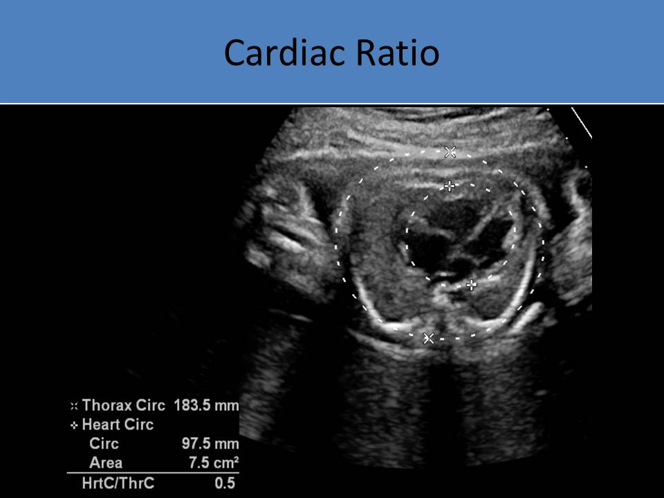 Fetal Echo Ultrasound Courses
