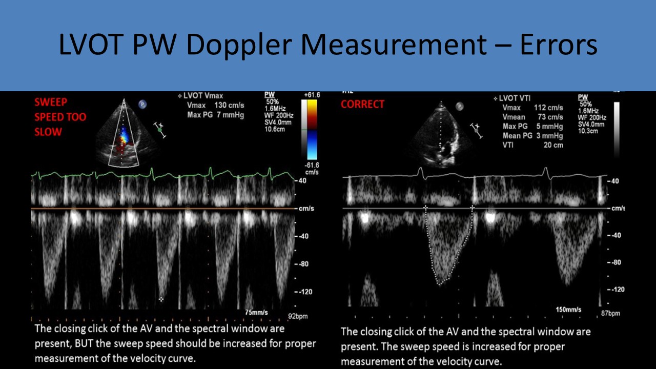 Adult echocardiography image 4