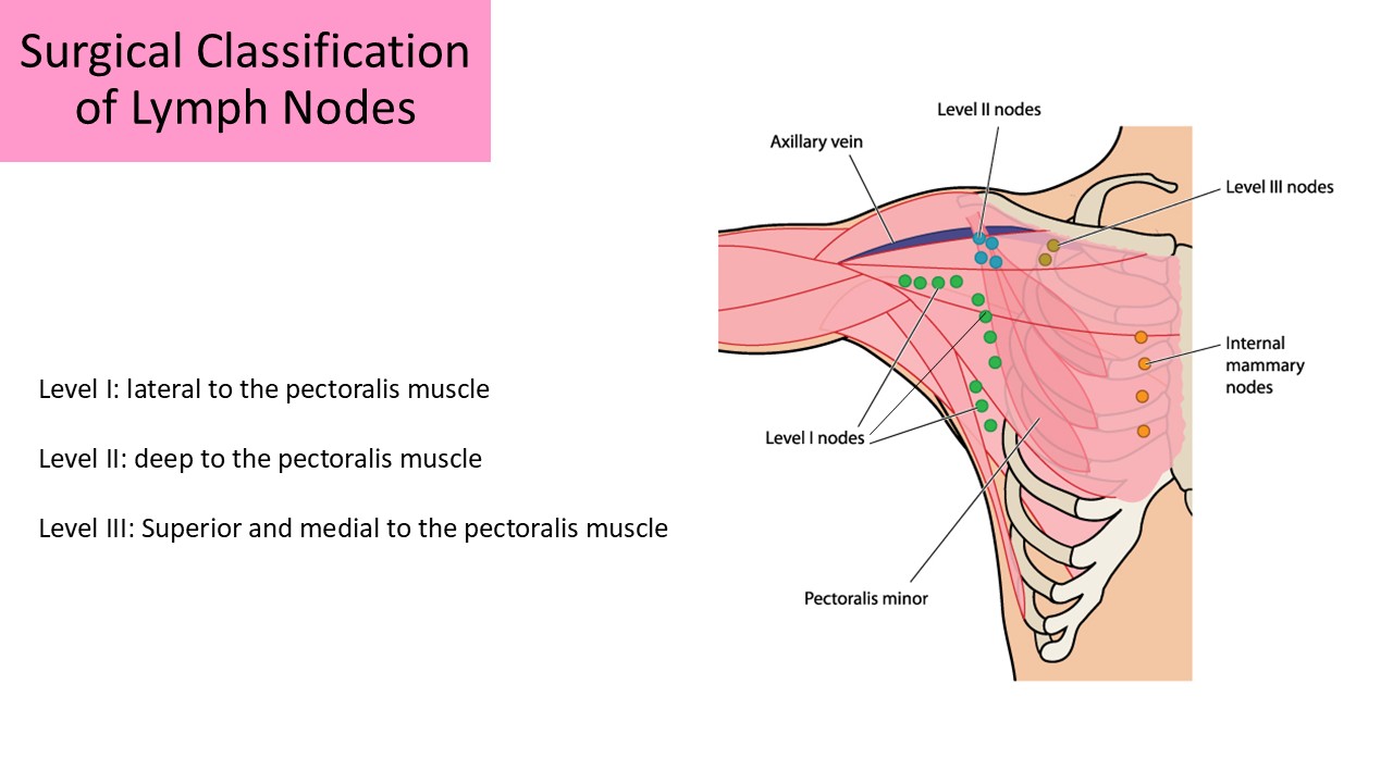 Surgical Classification of Lymph Nodes