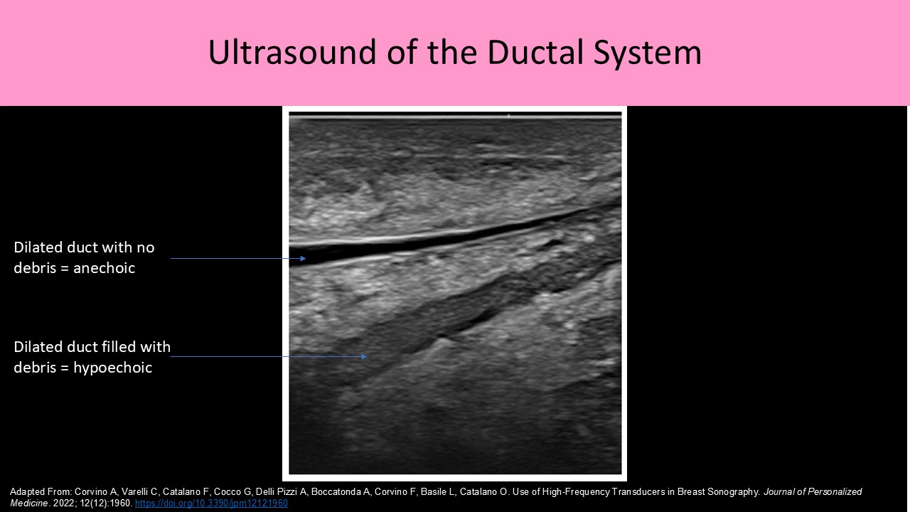 Ultrasound of the Ductal System