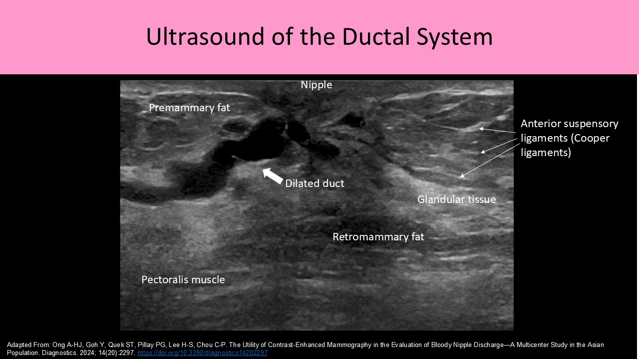 Ultrasound of the Ductal System