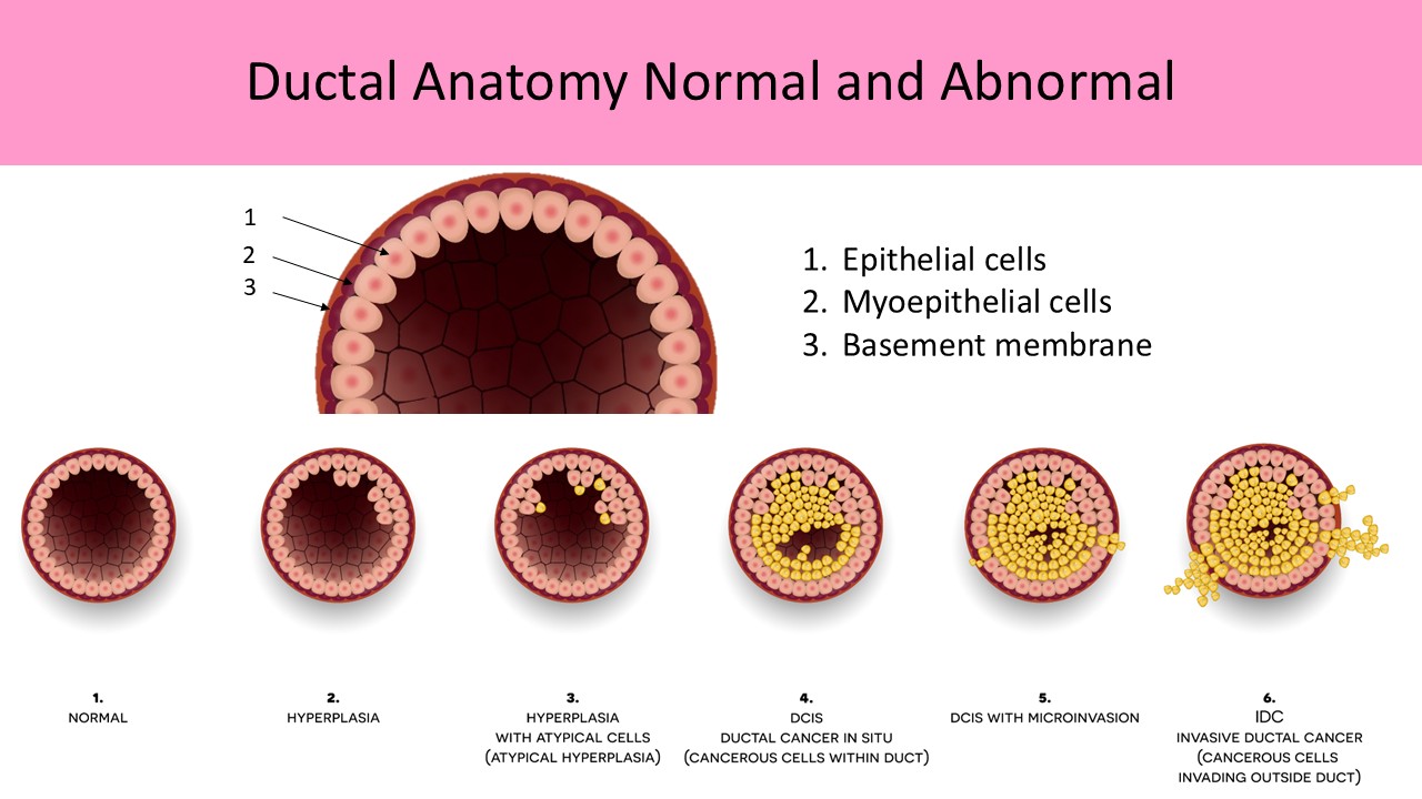 Normal and Abnormal ductal anatomy