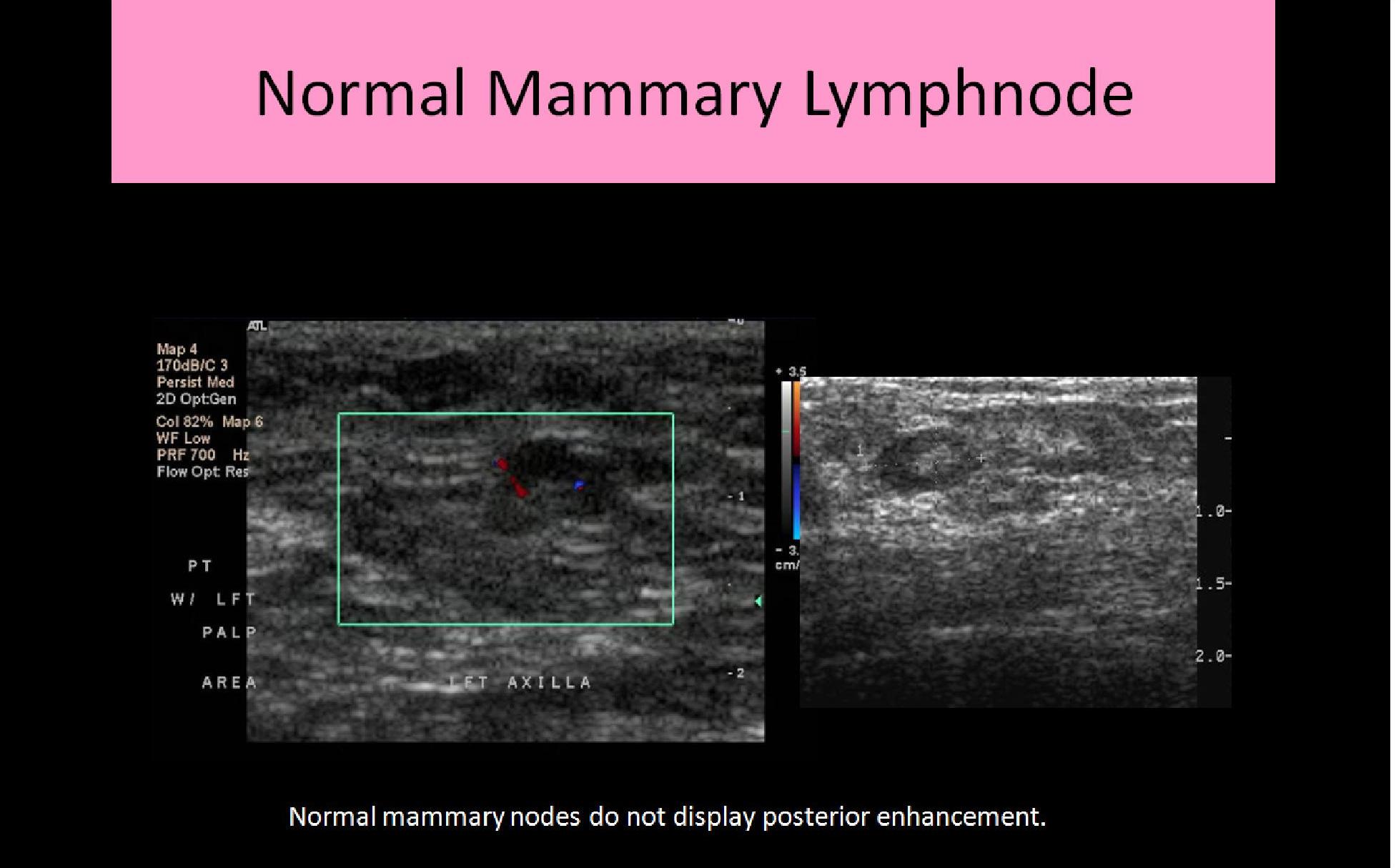 BREAST ANATOMY AND PHYSIOLOGY - Ultrasound Registry Review