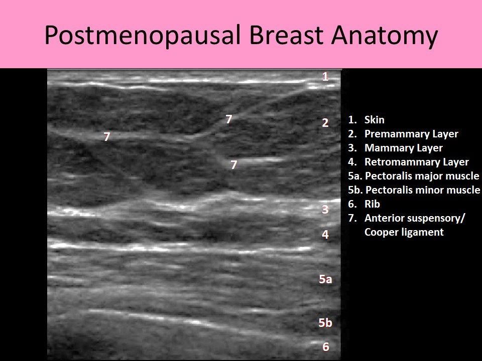 Postmenopausal Breast Anatomy
