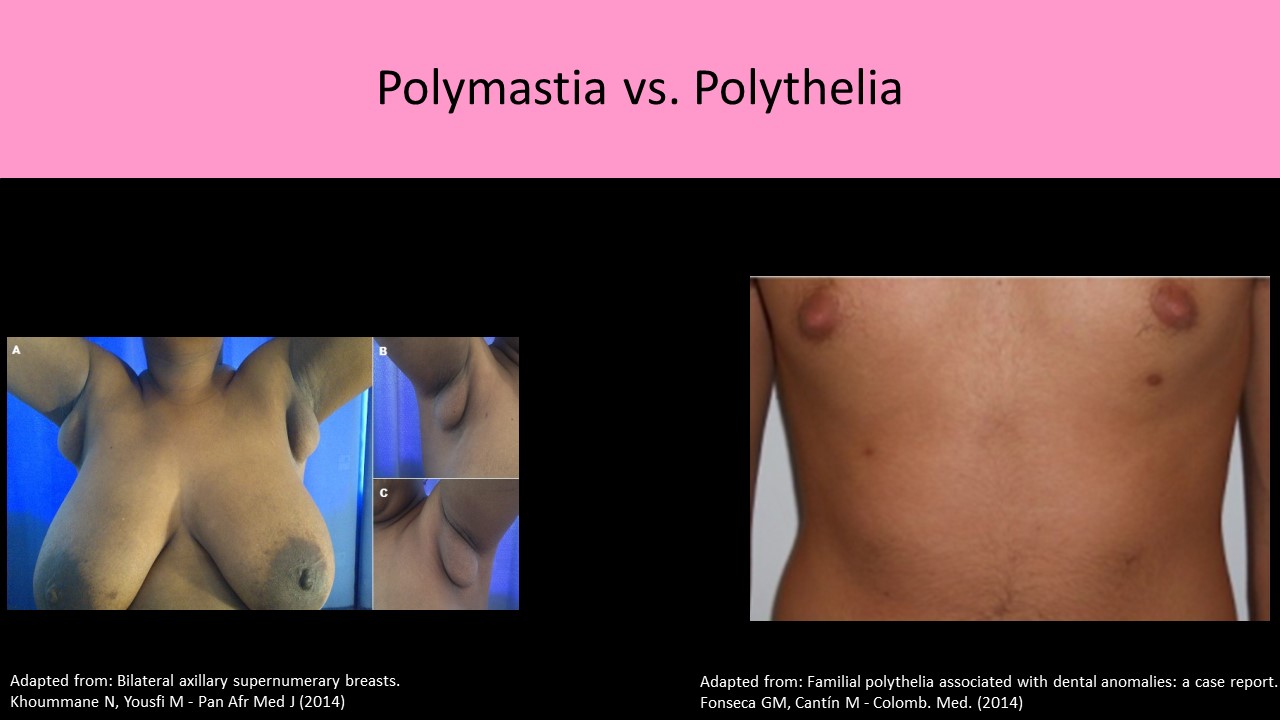 Breast Anatomy: Overview, Vascular Anatomy and Innervation of the Breast,  Breast Parenchyma and Support Structures