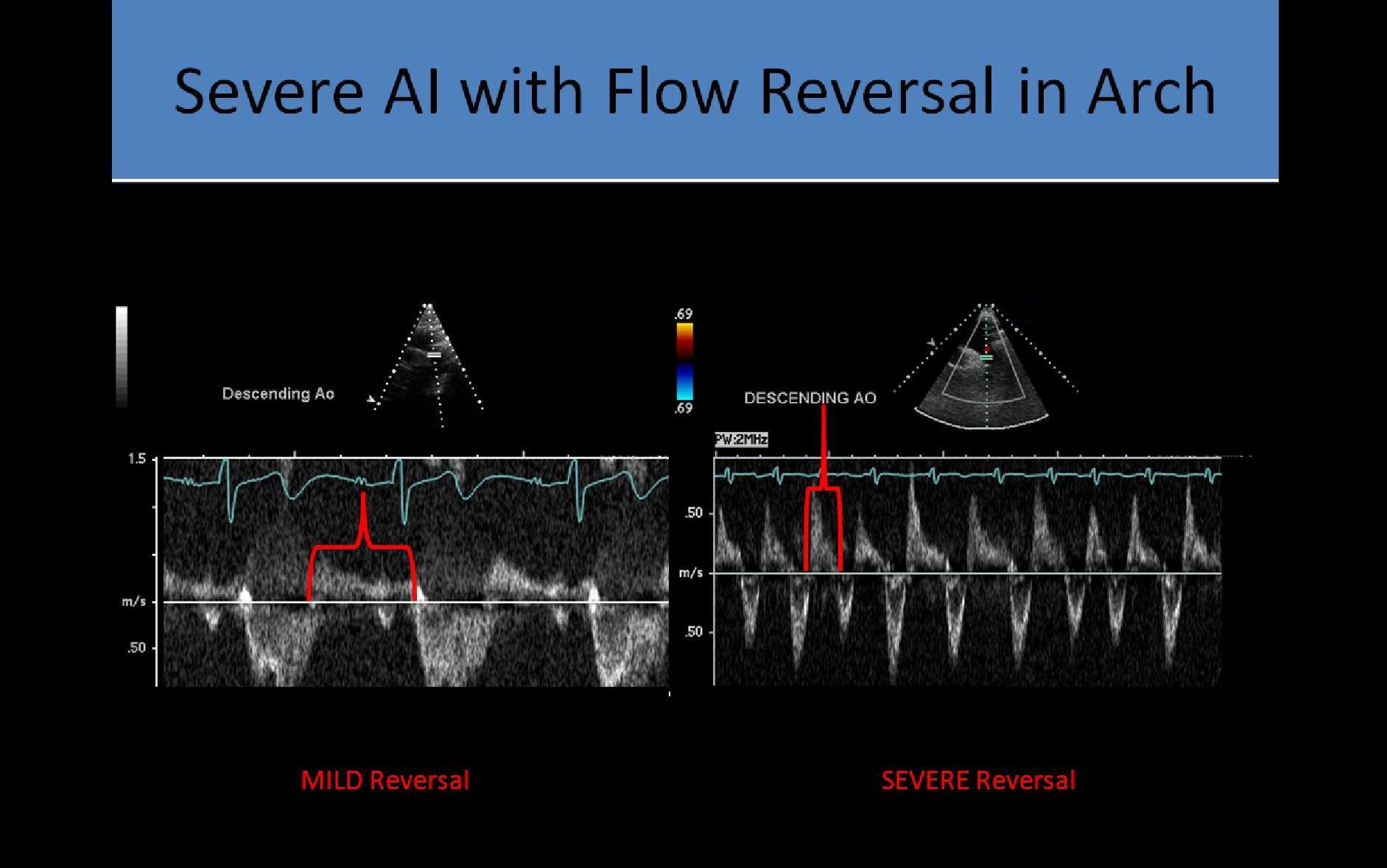 Ultrasound Registry Review - Valvular Abnormalities