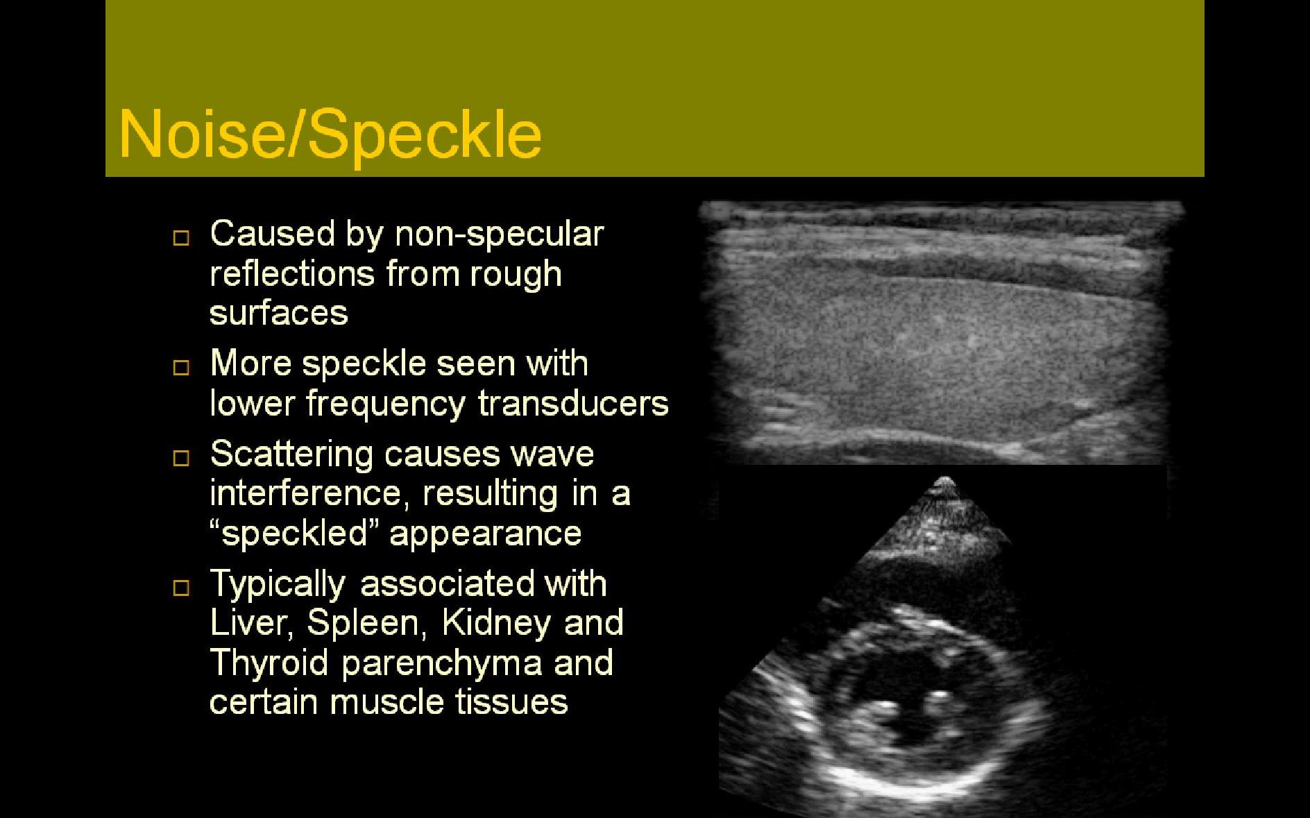 Noise/Speckle