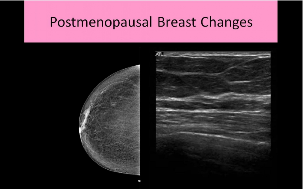 Ultrasound Registry Review