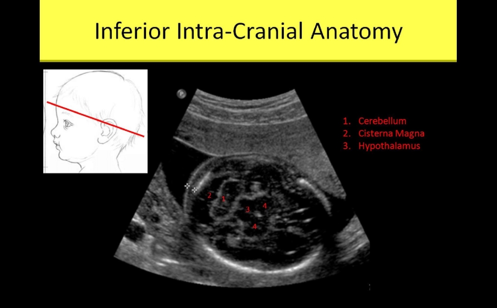 BREAST ANATOMY AND PHYSIOLOGY - Ultrasound Registry Review