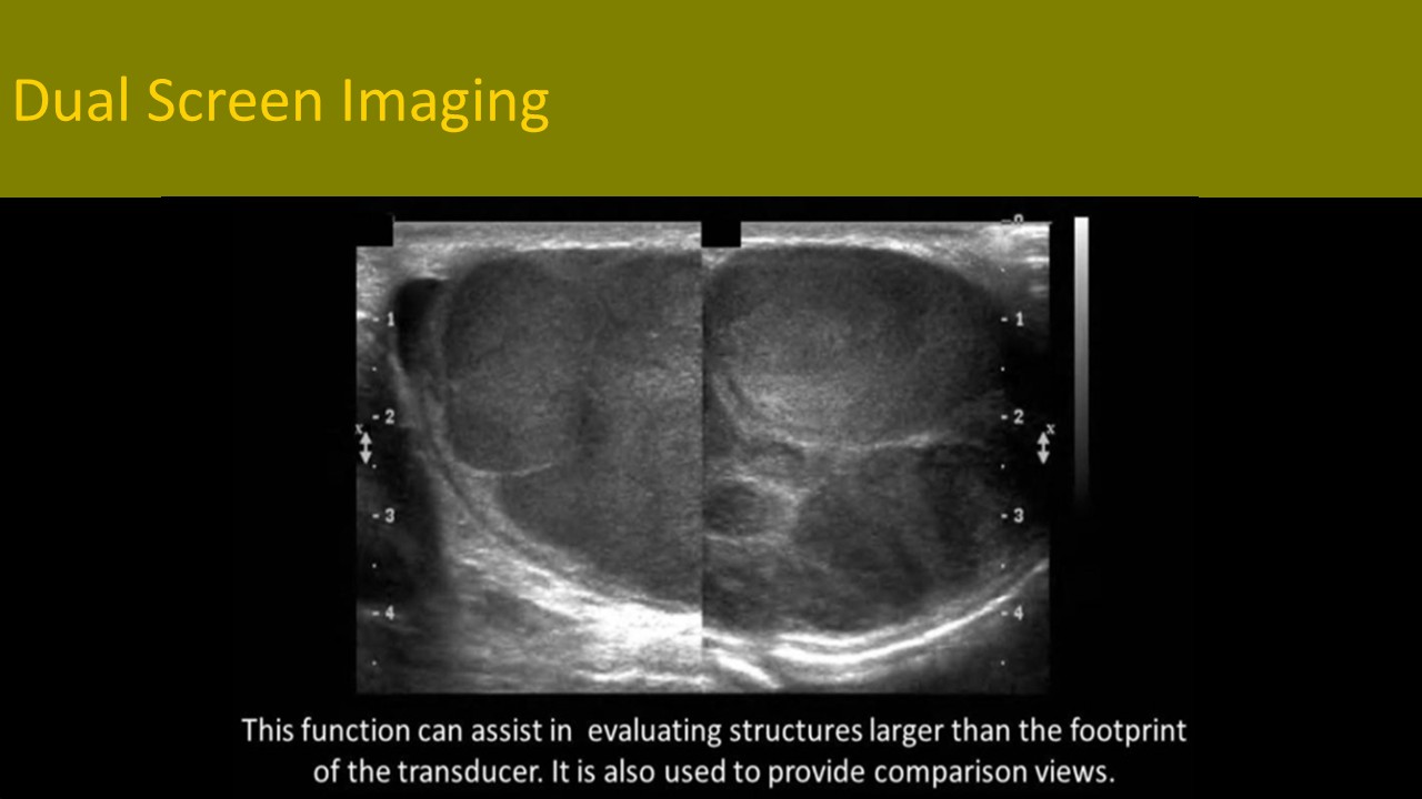Physics ultrasound image 6