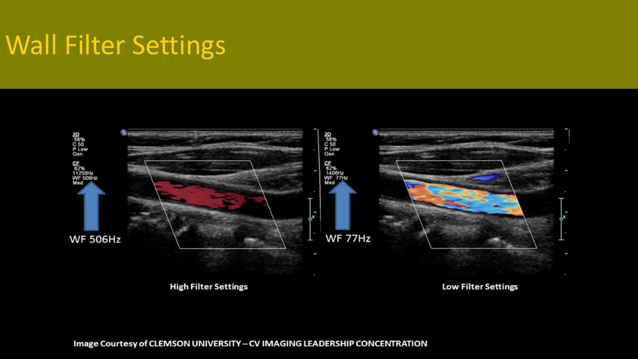 Physics ultrasound image 1