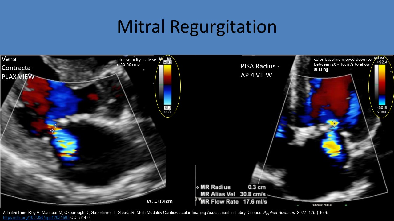 Adult echocardiography image 1
