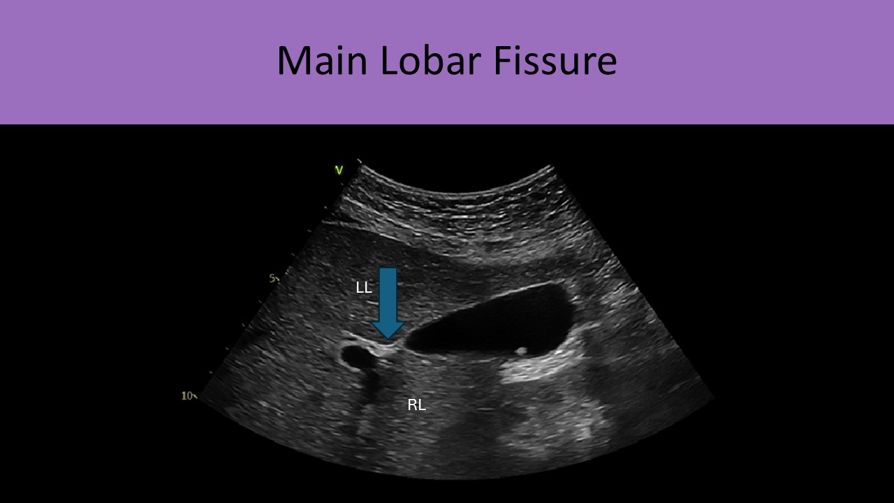 Abdominal ultrasound image 4