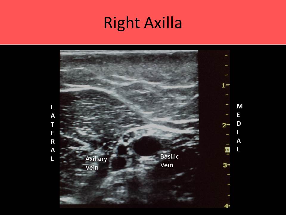 Ultrasound Registry Review - Extremity Venous