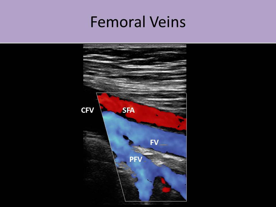 Extremity venous disease