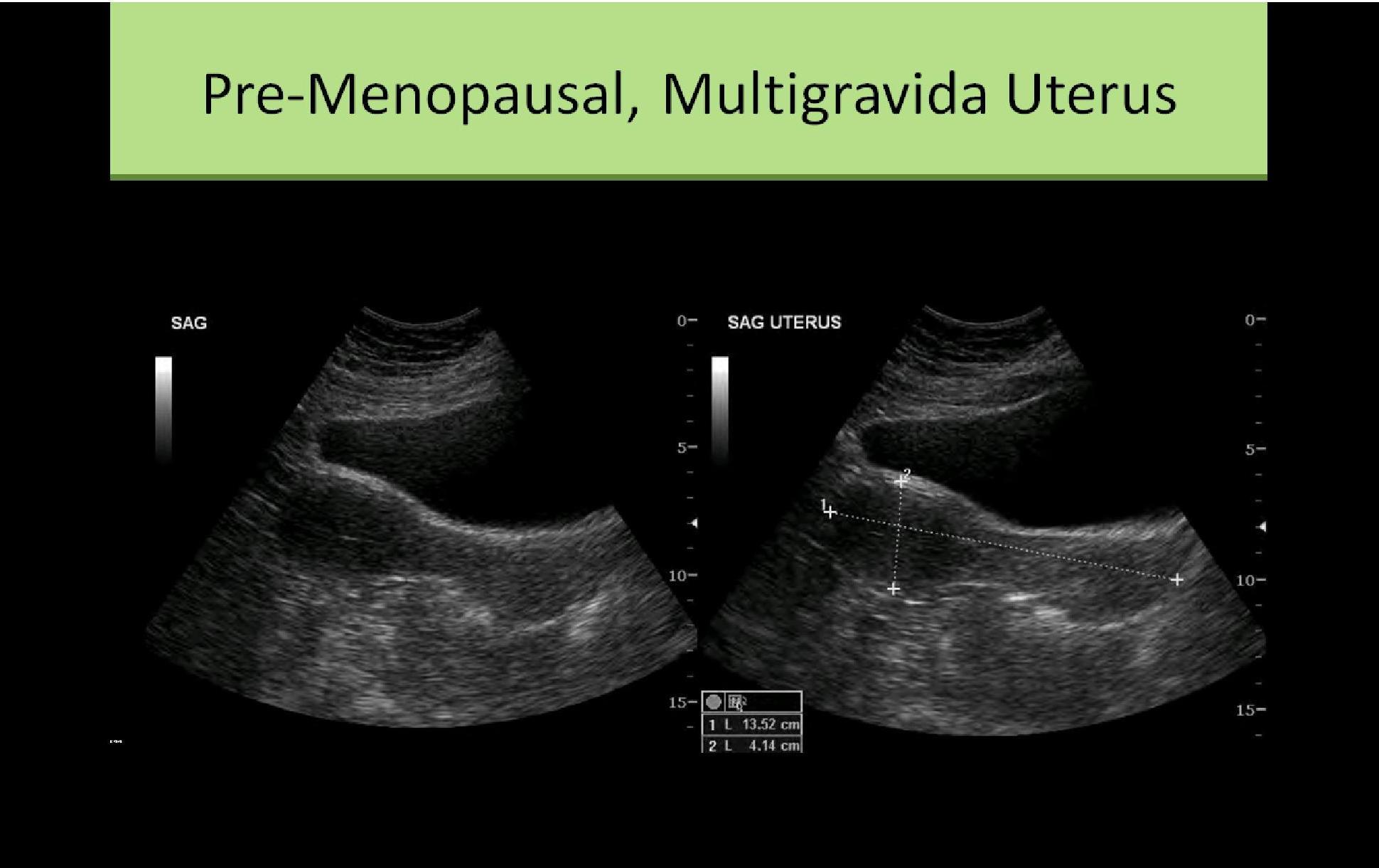 Ultrasound Registry Review - General Information