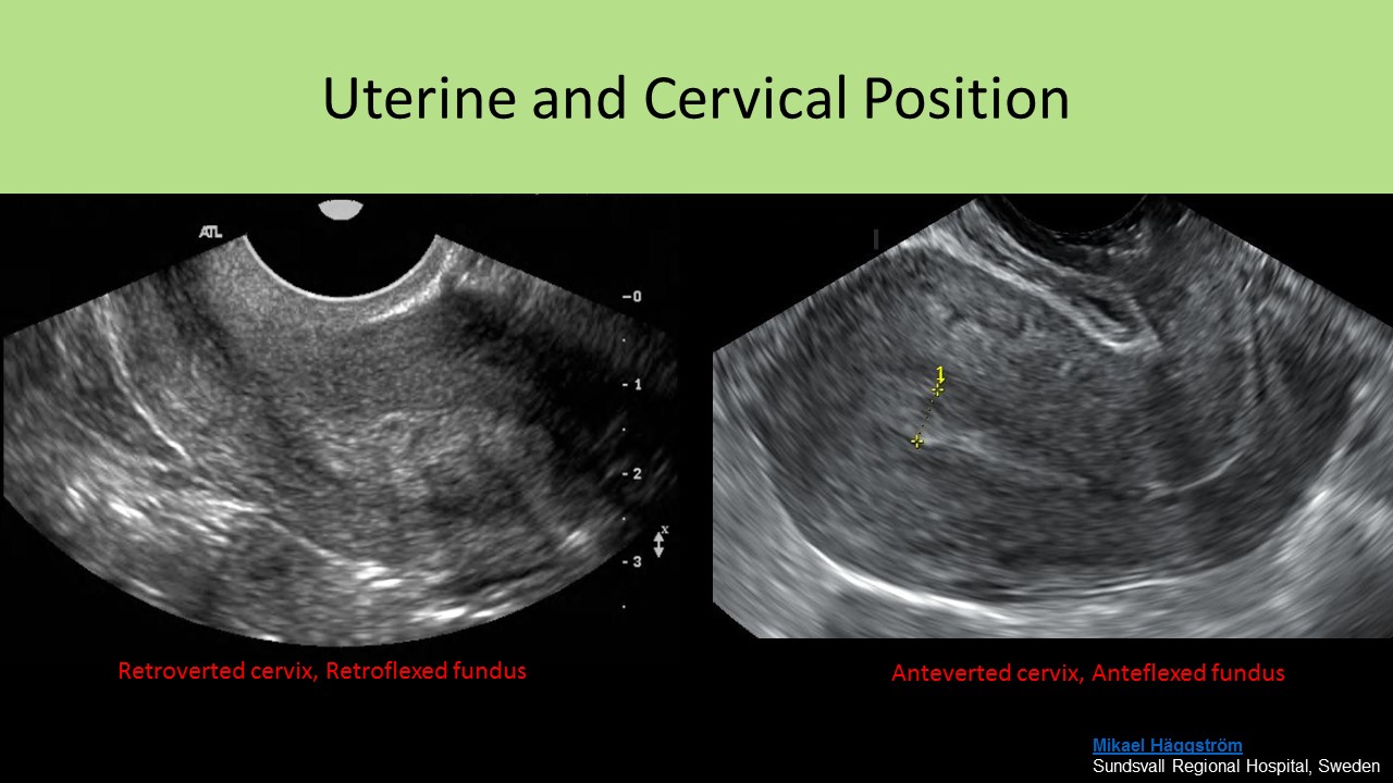 ultrasoundregistryreview.com. ultrasound uterine anatomy pelvic female. 