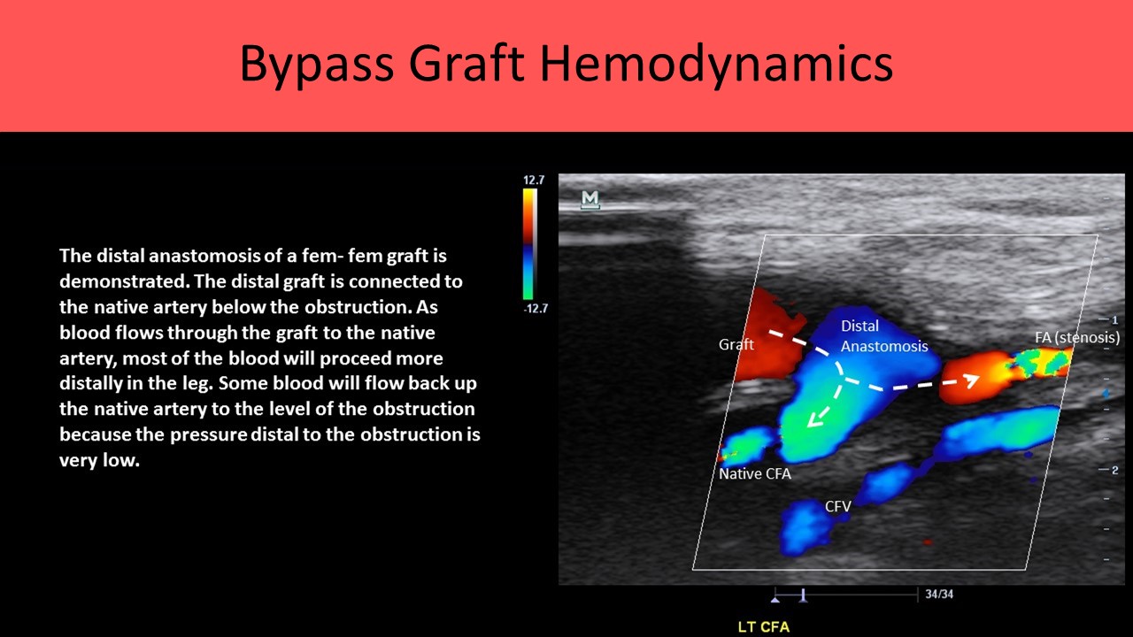 Vascular ultrasound image 3