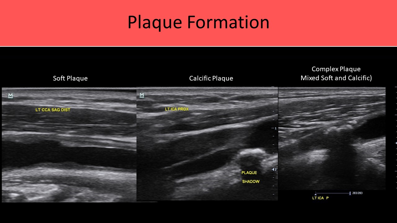 Ultrasound registry review sample image 7