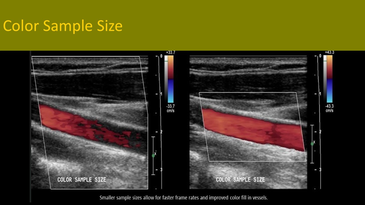 Ultrasound registry review sample image 4