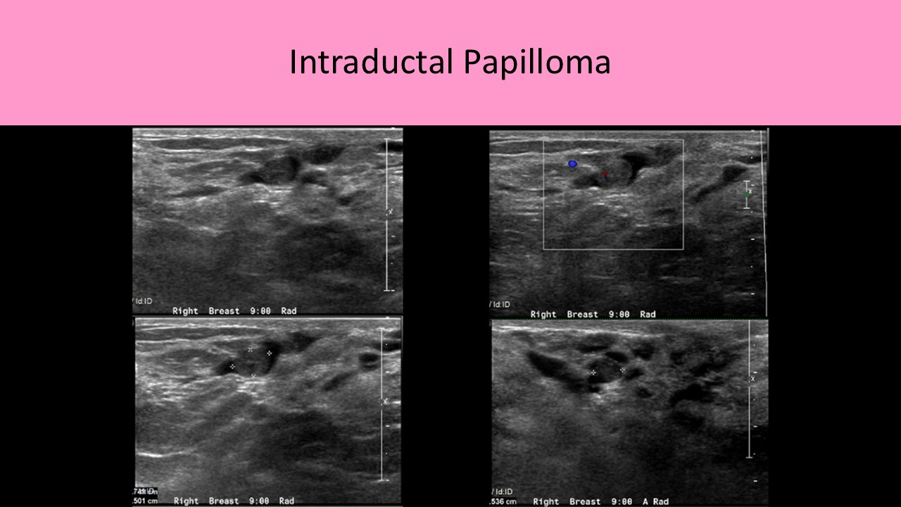 Ultrasound registry review sample image 6