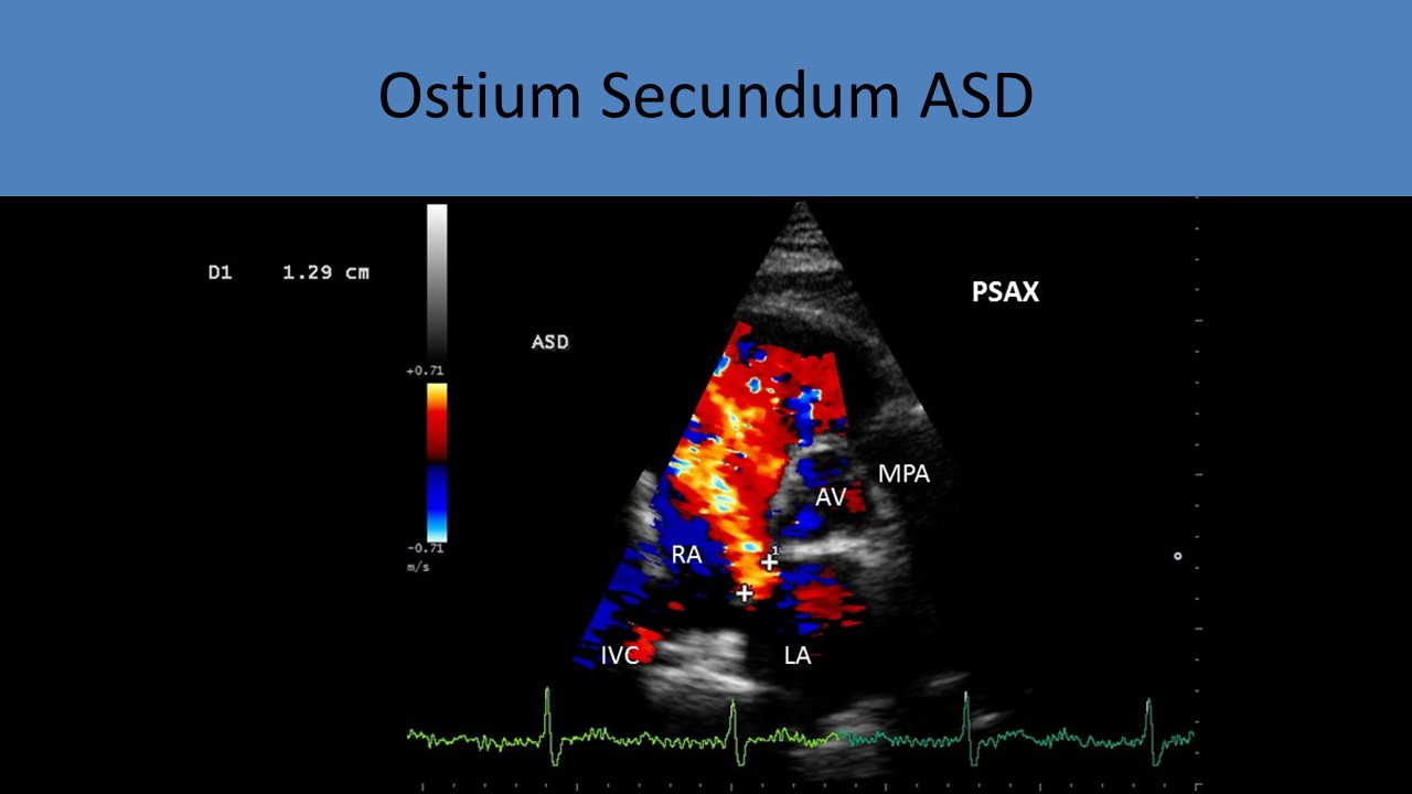 Ultrasound registry review sample image 11