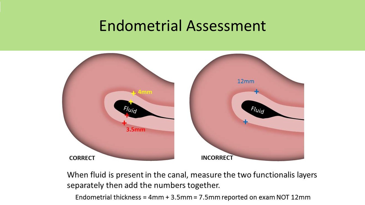 Ultrasound registry review sample image 3