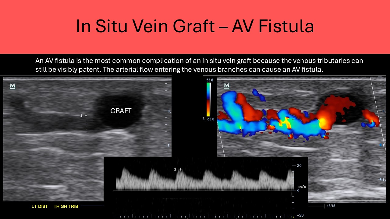 Ultrasound registry review sample image 12