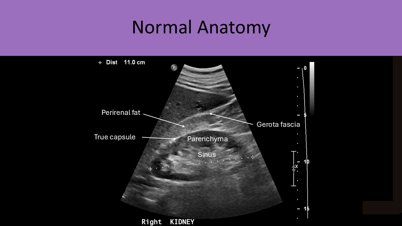 Ultrasound registry review sample image 5