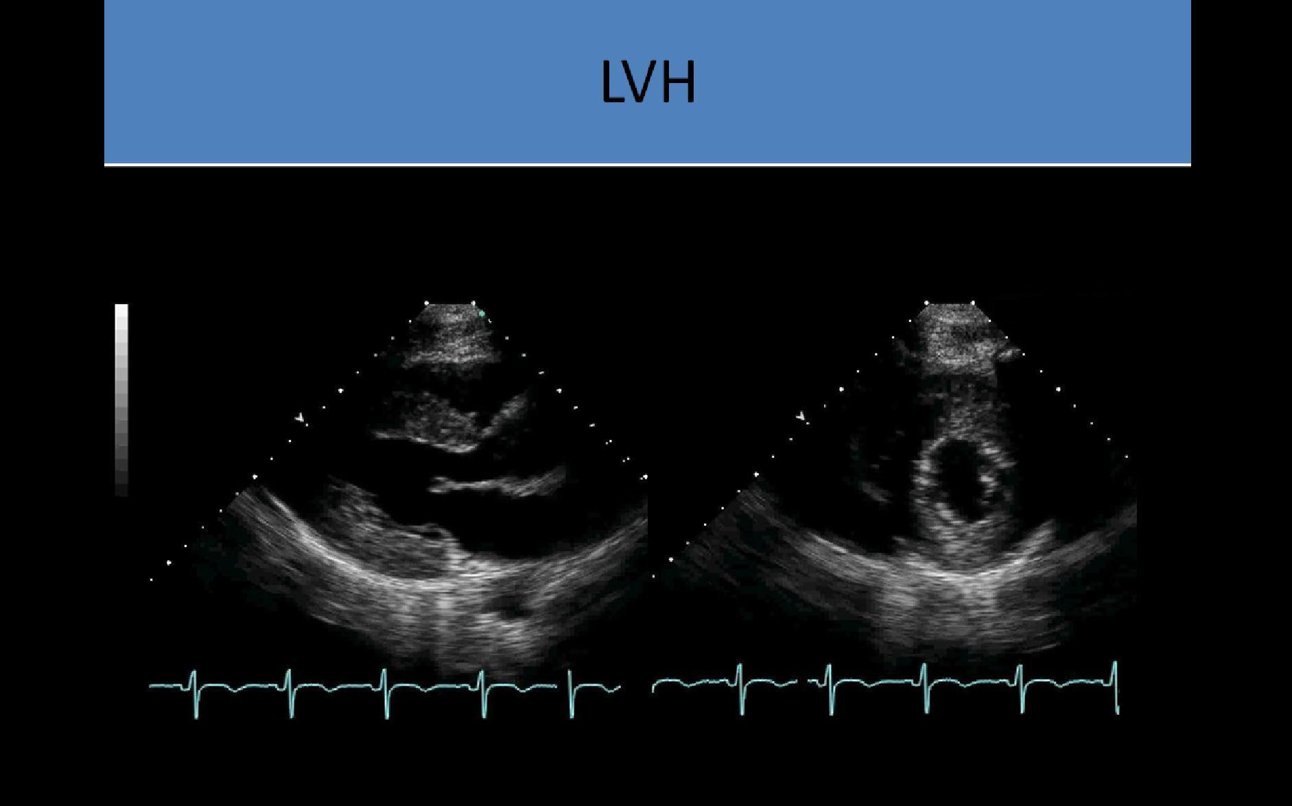 Echocardiography Registry Review