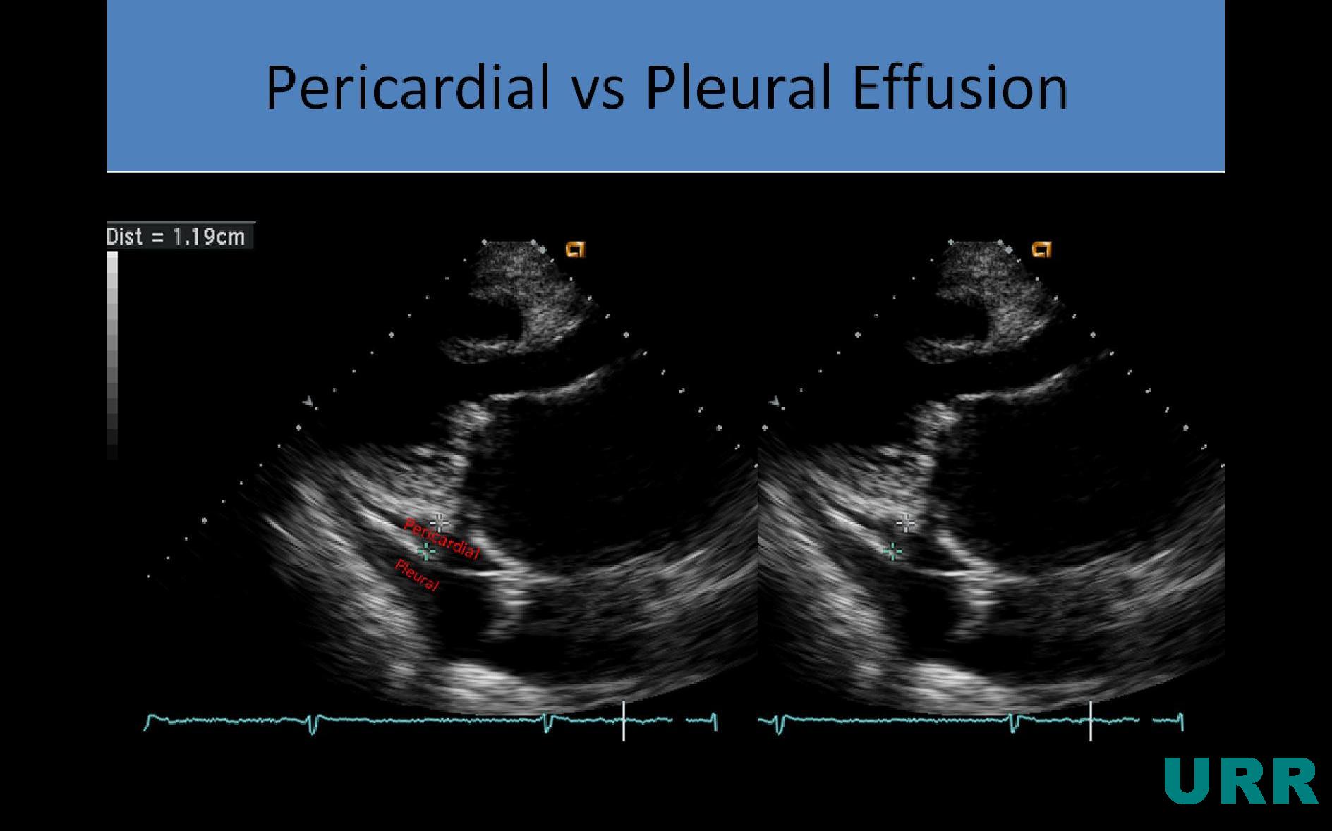 Ultrasound Registry Review - Echo Index