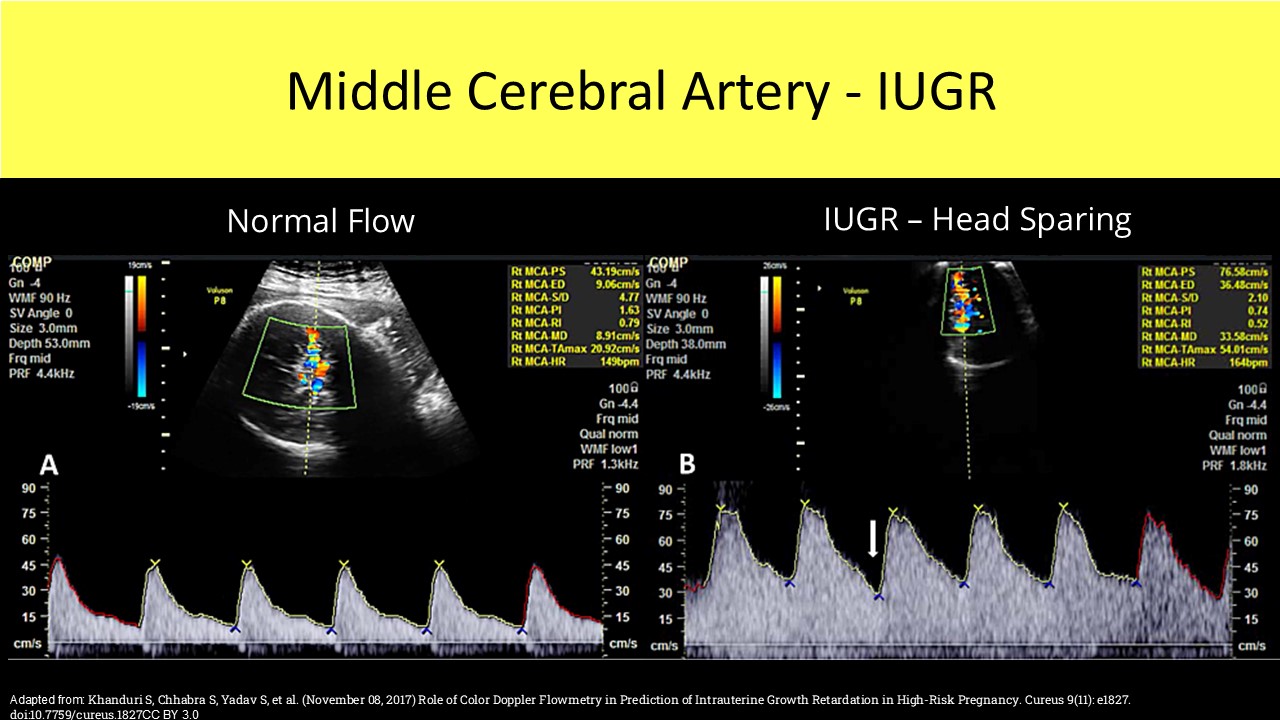 OB GYN ultrasound image 5