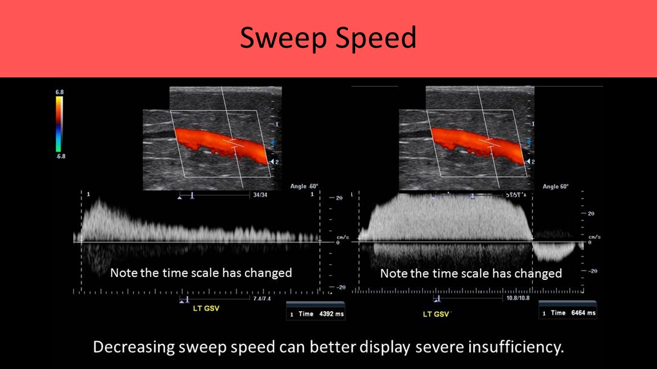 Vascular ultrasound image 7