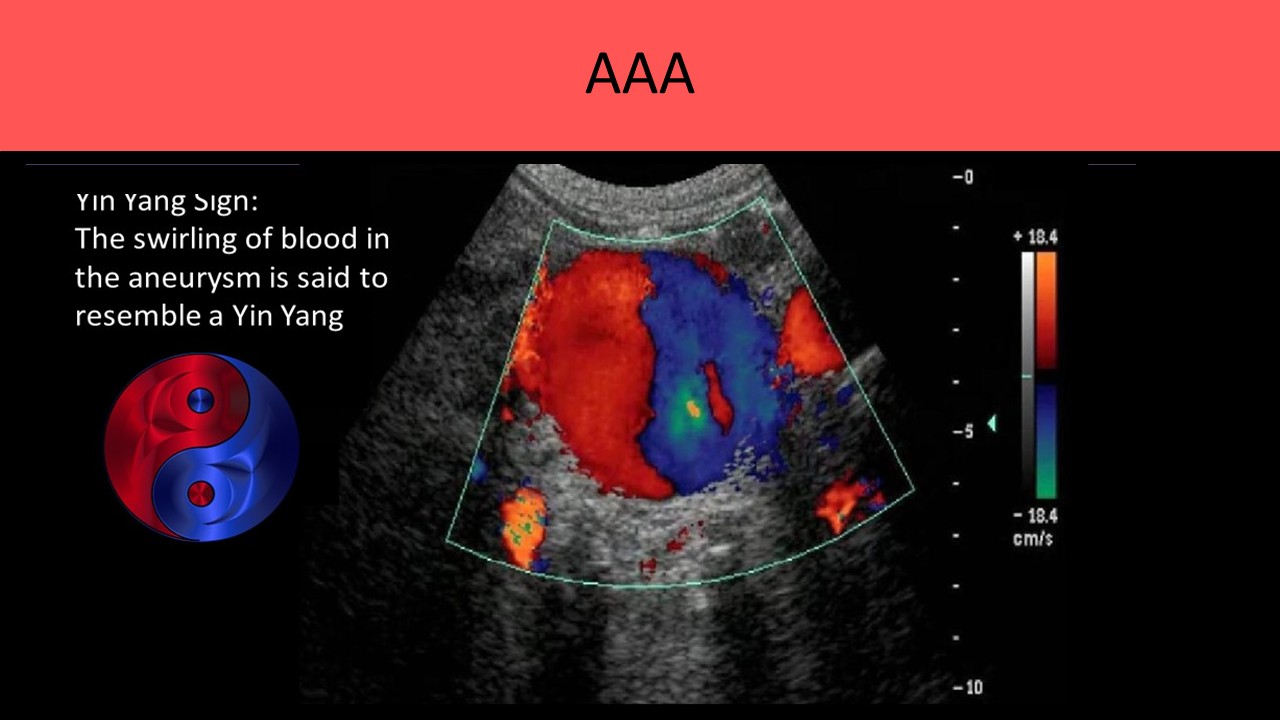Vascular ultrasound image 5