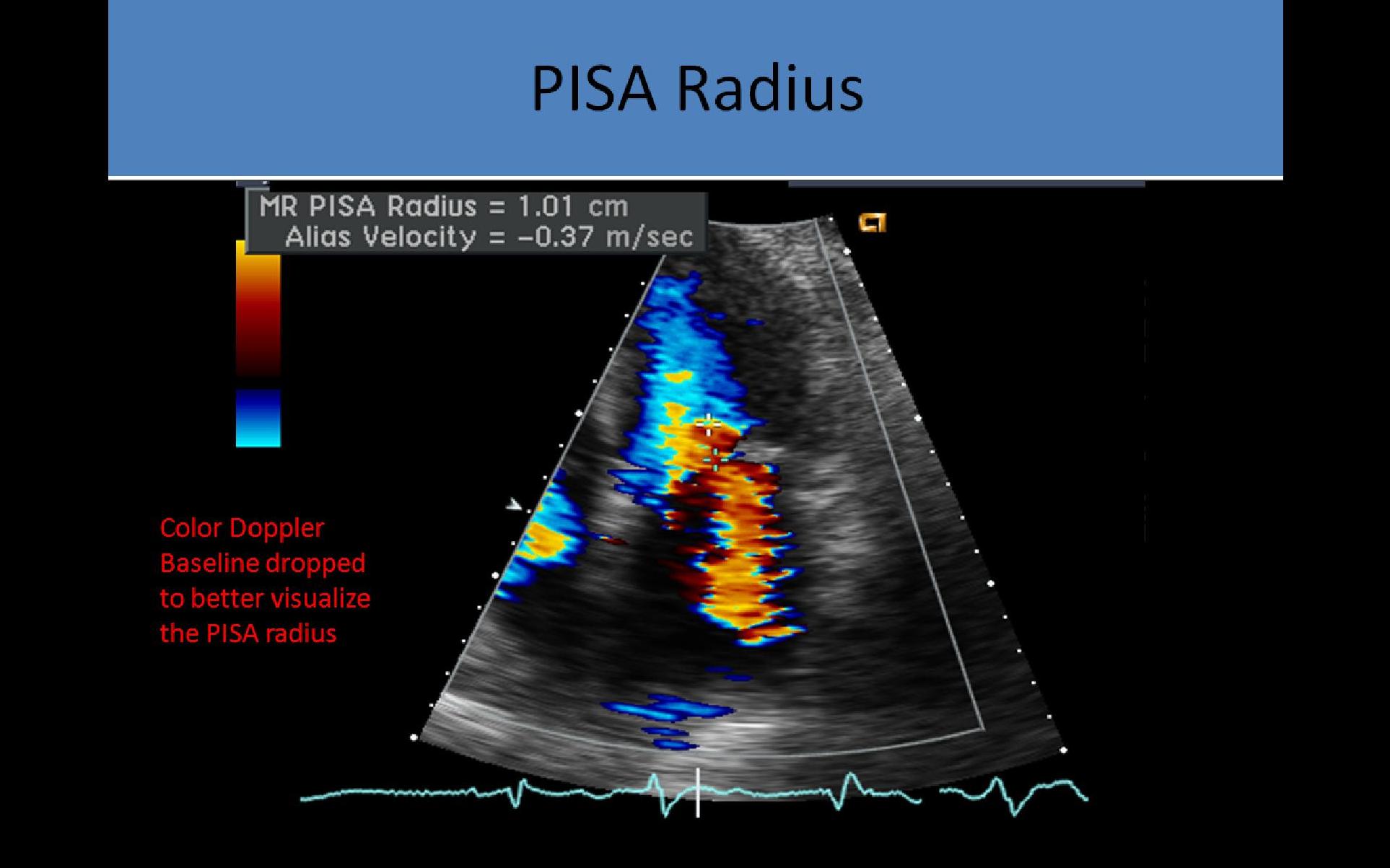Adult Echocardiography Registry Review